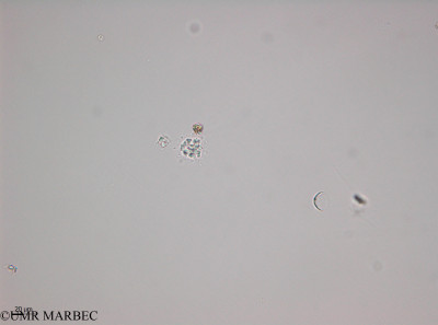 phyto/Thau_Lagoon/THAU_station1/OSU_plancton 2013/Corymbellus aureus (40x -140128)(copy)_thumb.jpg
